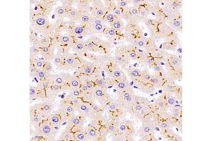 Immunohistochemistry of paraffin embedded human liver using Kiaa1324 (ABIN7073822) at dilution of 1:2500 (400x lens) (ELAPOR1 anticorps)