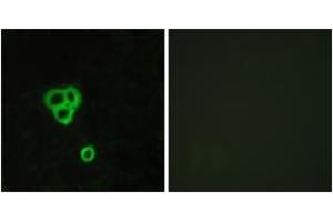 Immunofluorescence analysis of MCF7 cells, using GPR119 Antibody. (G Protein-Coupled Receptor 119 anticorps  (AA 186-235))