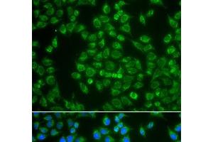 Immunofluorescence analysis of A549 cells using MAP4K3 Polyclonal Antibody (MAP4K3 anticorps)