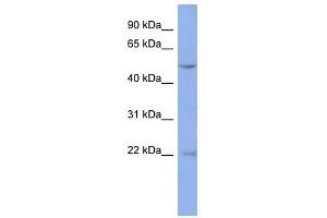 DAZ3 antibody used at 1 ug/ml to detect target protein. (DAZ3 anticorps  (Middle Region))