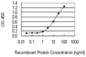 anti-Nucleoside-Triphosphatase, Cancer-Related (NTPCR) (AA 91-190) antibody