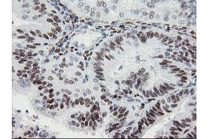 Image no. 2 for anti-Transducin-Like Enhancer of Split 1 (E(sp1) Homolog, Drosophila) (TLE1) (AA 180-460) antibody (ABIN1491047)