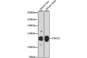 Western blot analysis of extracts of various cell lines, using CWC22 antibody. (CWC22 anticorps)