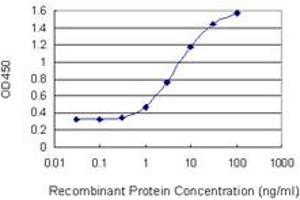 Detection limit for recombinant GST tagged GALK1 is 0.