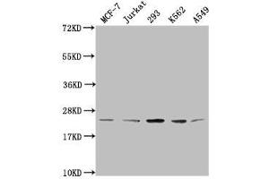 Western Blot Positive WB detected in: MCF-7 whole cell lysate, Jurkat whole cell lysate, 293 whole cell lysate, K562 whole cell lysate, A549 whole cell lysate All lanes: HIST1H1C antibody at 1:2000 Secondary Goat polyclonal to rabbit IgG at 1/40000 dilution Predicted band size: 22 kDa Observed band size: 22 kDa (HIST1H1C anticorps  (meLys96))