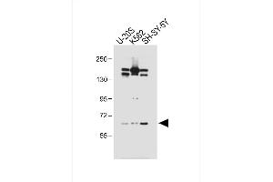 All lanes : Anti-LM3 Antibody (C-term) at 1:1000 dilution Lane 1: U-20S whole cell lysate Lane 2: K562 whole cell lysate Lane 3: SH-SY-5Y whole cell lysate Lysates/proteins at 20 μg per lane. (PALM3 anticorps  (C-Term))