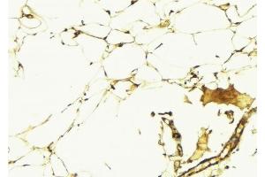 ABIN6275972 at 1/100 staining Human lung tissue by IHC-P.