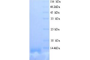 SDS-PAGE (SDS) image for Spondin 1 (SPON1) (AA 33-364) protein (His tag) (ABIN5714140)