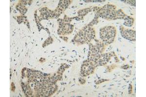 Image no. 1 for anti-Fibroblast Growth Factor 10 (FGF10) antibody (ABIN464942) (FGF10 anticorps)