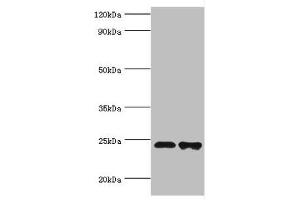 Western blot All lanes: Toll/interleukin-1 receptor domain-containing adapter protein antibody at 2 μg/mL Lane 1: K562 whole cell lysate Lane 2: Mouse kidney tissue Secondary Goat polyclonal to rabbit IgG at 1/10000 dilution Predicted band size: 24, 26, 28 kDa Observed band size: 24 kDa