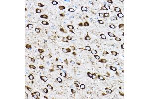 Immunohistochemistry of paraffin-embedded rat brain using RPL17 Rabbit pAb (ABIN6128342, ABIN6147115, ABIN6147116 and ABIN6221632) at dilution of 1:100 (40x lens). (RPL17 anticorps  (AA 1-184))