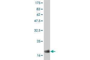 Western Blot detection against Immunogen (19. (IFNA2 anticorps  (AA 24-188))