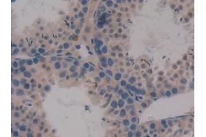 Detection of CXCL16 in Mouse Testis Tissue using Polyclonal Antibody to Chemokine C-X-C-Motif Ligand 16 (CXCL16)