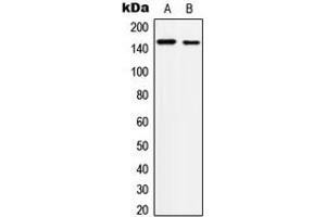 Western blot analysis of c-Met (pY1234) expression in A431 (A), HepG2 (B) whole cell lysates. (c-MET anticorps  (C-Term, pTyr1234))
