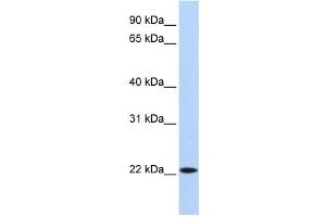 Western Blotting (WB) image for anti-Synovial Sarcoma, X Breakpoint 5 (SSX5) antibody (ABIN2458407) (SSX5 anticorps)