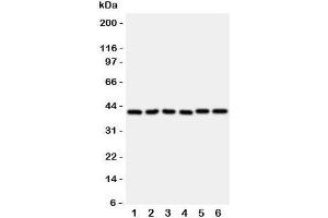 Western blot testing of WISP1 antibody and rat samples 1: heart;  2: kidney;  3: lung;  and human samples 4: A549;  5: A431;  6: COLO320 cell lysate (WISP1 anticorps  (C-Term))