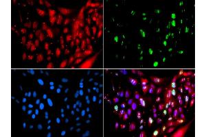 Immunofluorescence analysis of GFP-RNF168 transgenic U2OS cells using UIMC1 antibody (ABIN5974363).
