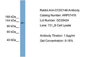 WB Suggested Anti-CCDC146  Antibody Titration: 0. (CCDC146 anticorps  (Middle Region))