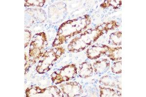 Immunohistochemistry of paraffin-embedded mouse kidney using  Rabbit mAb (ABIN7265591) at dilution of 1:100 (40x lens).