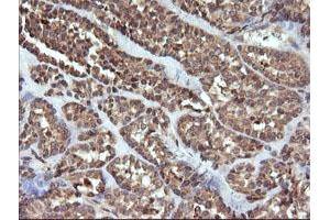 Image no. 3 for anti-Ubiquitin-Conjugating Enzyme E2G 2 (UBE2G2) antibody (ABIN1501631)