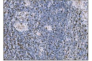 IHC analysis of Fos B/FOSB using anti-Fos B/FOSB antibody (ABIN7599279). (FOSB anticorps  (AA 1-332))