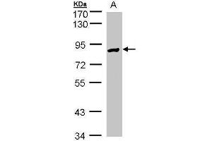 WB Image Sample(30 ug whole cell lysate) A:Hep G2 , 7. (Glucose-6-Phosphate Dehydrogenase anticorps)
