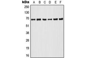 Western blot analysis of A-RAF (pY302) expression in HeLa PMA-treated (A), Raji (B), HT29 (C), NIH3T3 (D), SP2/0 PMA-treated (E), PC12 PMA-treated (F) whole cell lysates. (ARAF anticorps  (pTyr302))