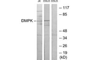 Western blot analysis of extracts from Jurkat/COLO205 cells, using DMPK Antibody. (DMPK anticorps  (AA 11-60))
