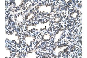 KCTD6 antibody was used for immunohistochemistry at a concentration of 16. (KCTD6 anticorps  (N-Term))