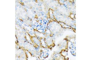 Immunohistochemistry of paraffin-embedded mouse kidney using Alpha-2-Macroglobulin (Alpha-2-Macroglobulin (M)) Rabbit mAb (ABIN7265558) at dilution of 1:100 (40x lens).