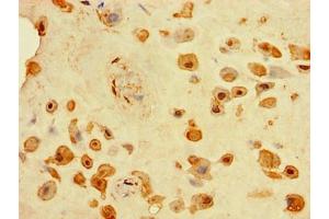 Immunohistochemistry of paraffin-embedded human placenta tissue using ABIN7173756 at dilution of 1:100 (TINAGL1 anticorps  (AA 250-467))