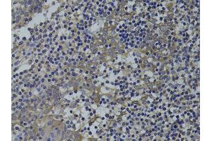 Immunohistochemistry of paraffin-embedded human tonsil using GNA15 antibody (ABIN1872841) at dilution of 1:100 (40x lens). (GNA15 anticorps)