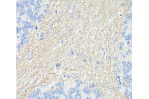 Immunohistochemistry of paraffin-embedded Rat brain using THY1 Polyclonal Antibody at dilution of 1:100 (40x lens). (CD90 anticorps)