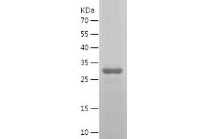 Western Blotting (WB) image for Signal Transducer and Activator of Transcription 6, Interleukin-4 Induced (STAT6) (AA 2-281) protein (His tag) (ABIN7125096)
