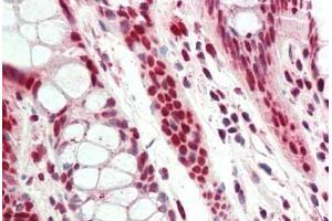 Human, Colon: Formalin-Fixed Paraffin-Embedded (FFPE)