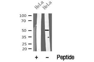 Western blot analysis of MST3 in lysates of HeLa? (STK24 anticorps  (N-Term))