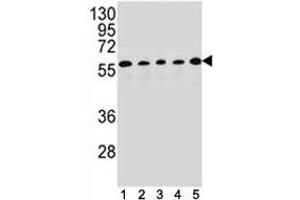 PAX1 antibody western blot analysis in (1) HepG2, (2) MDA-MB453, (3) 293, (4) K562 and (5) MCF-7 lysate.