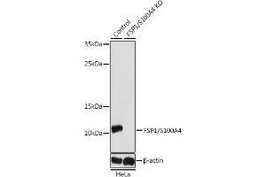 Western blot analysis of extracts from normal (control) and FSP1/S100 knockout (KO) HeLa cells, using FSP1/S100 antibody (ABIN3022287, ABIN3022288, ABIN3022289, ABIN1513494 and ABIN1514638) at 1:1000 dilution. (s100a4 anticorps  (AA 1-101))