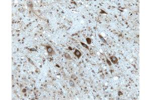 Rat cerebellum, formalin-fixed paraffin embedded tissue, with citrate pre-treatment, 20X. (Gephyrin anticorps  (AA 569-726))