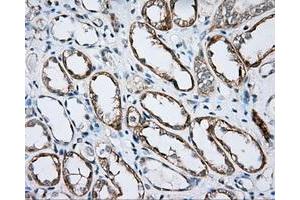 Image no. 5 for anti-Bruton Agammaglobulinemia tyrosine Kinase (BTK) antibody (ABIN1496974) (BTK anticorps)