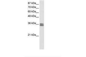 Image no. 1 for anti-Calcium Channel, Voltage-Dependent, gamma Subunit 4 (CACNG4) (AA 51-100) antibody (ABIN202252)