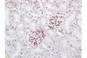 Formalin-fixed and paraffin embedded mouse kidney labeled with Rabbit Anti-PRMT6 Polyclonal Antibody, Unconjugated (ABIN761876) at 1:200 followed by conjugation to the secondary antibody and DAB staining (PRMT6 anticorps  (AA 301-375))