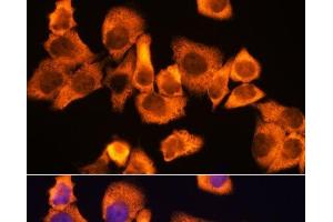 Immunofluorescence analysis of HeLa cells using RPS3 Polyclonal Antibody at dilution of 1:100.