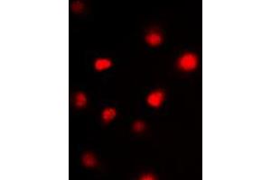 Immunofluorescent analysis of GATA3 staining in HeLa cells. (GATA3 anticorps  (Center))