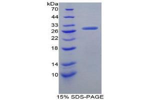 SDS-PAGE (SDS) image for Granulin (GRN) (AA 31-269) protein (His tag) (ABIN2125061)