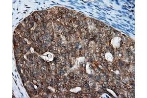 Immunohistochemical staining of paraffin-embedded Kidney tissue using anti-RALBP1 mouse monoclonal antibody. (RALBP1 anticorps)