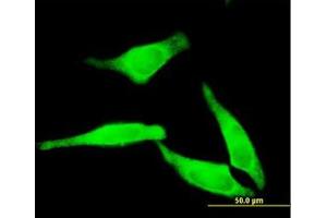 Image no. 1 for anti-5'-Nucleotidase, Cytosolic II (NT5C2) (AA 1-562) antibody (ABIN599188) (NT5C2 anticorps  (AA 1-562))
