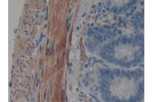 DAB staining on IHC-P; Samples: Rat Intestine Tissue (WIF1 anticorps  (AA 38-247))