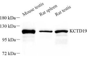 Western blot analysis of KCTD19 (ABIN7075147) at dilution of 1: 50 (KCTD19 anticorps)