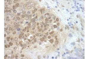 Immunohistochemistry (IHC) image for anti-Cell Division Cycle 6 Homolog (S. Cerevisiae) (CDC6) (AA 1-50) antibody (ABIN7448469)